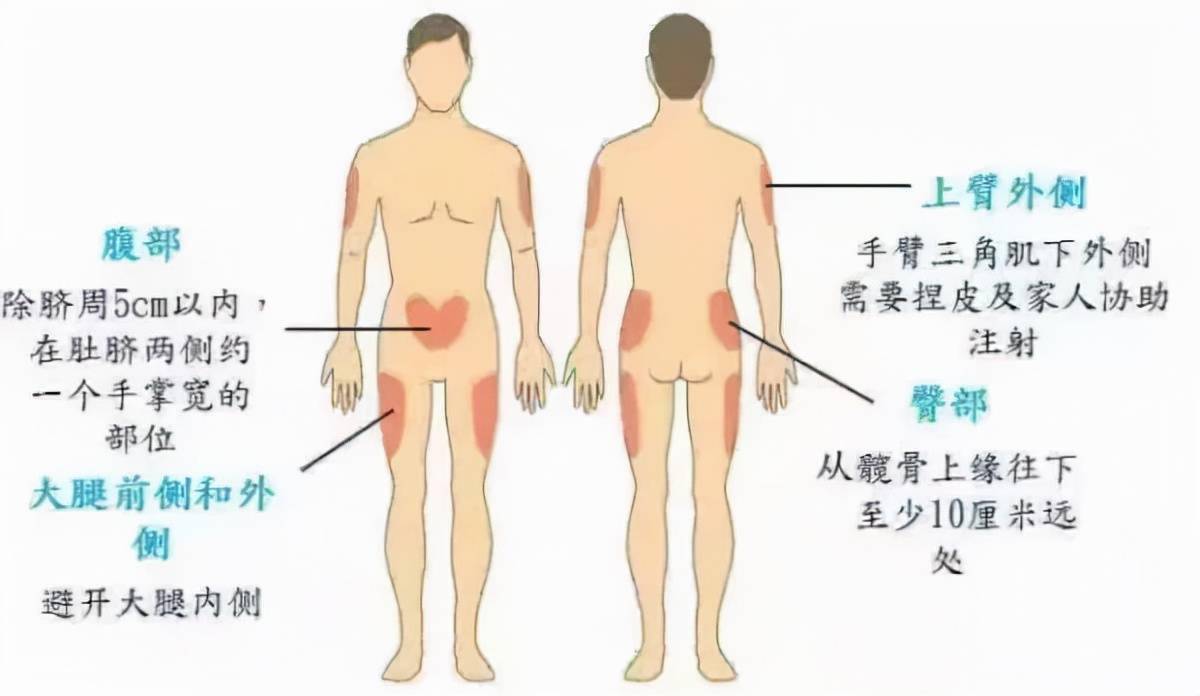 如何正确自行注射胰岛素?专家手把手教你正确操作,早看早受益