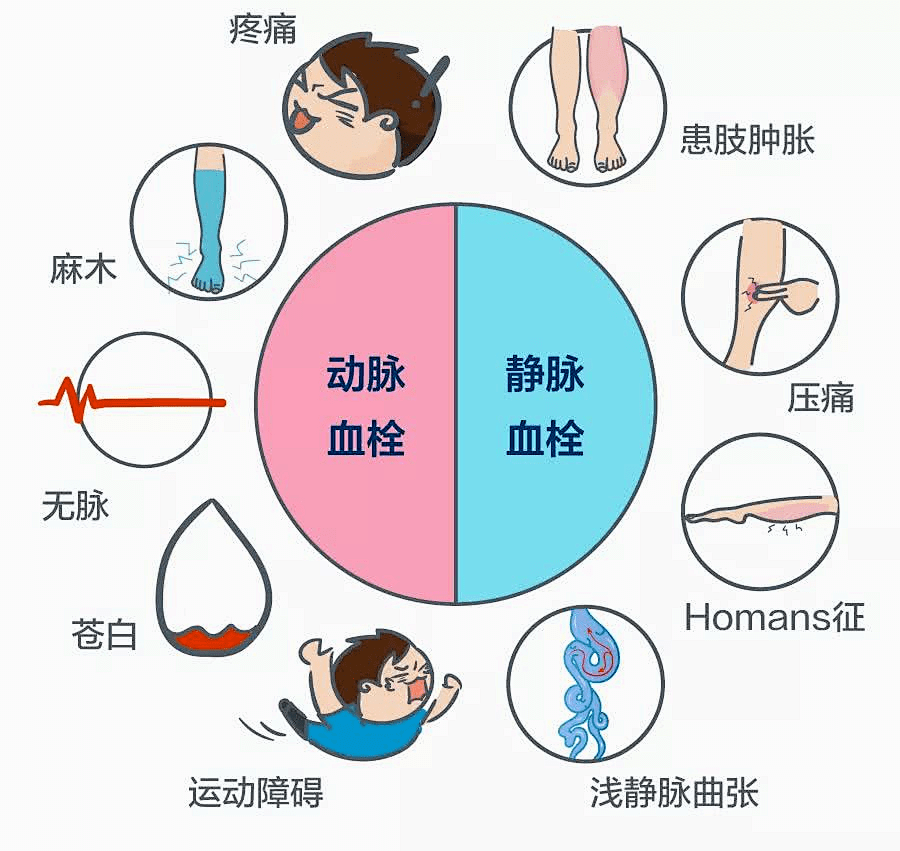 10.13世界血栓日——栓不住,动起来,附:宣传视频