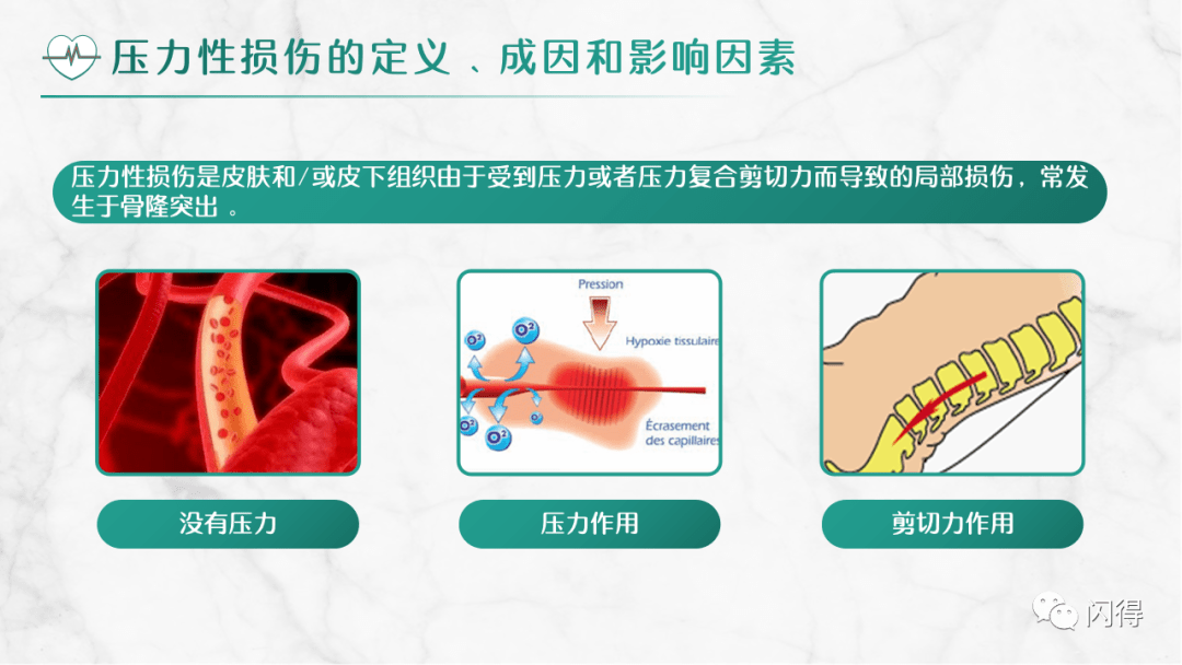 【ppt】压力性损伤预防与护理