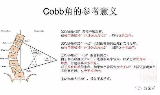 骨科常用的角度测量方法汇总,全在这里了!