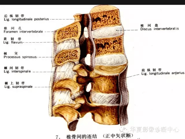 腰椎影像解剖及常见病变