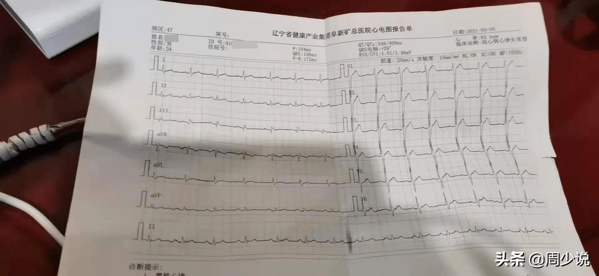 去医院检查,结果查出心脏不好,当时所做的心电图报告显示为"冠心病