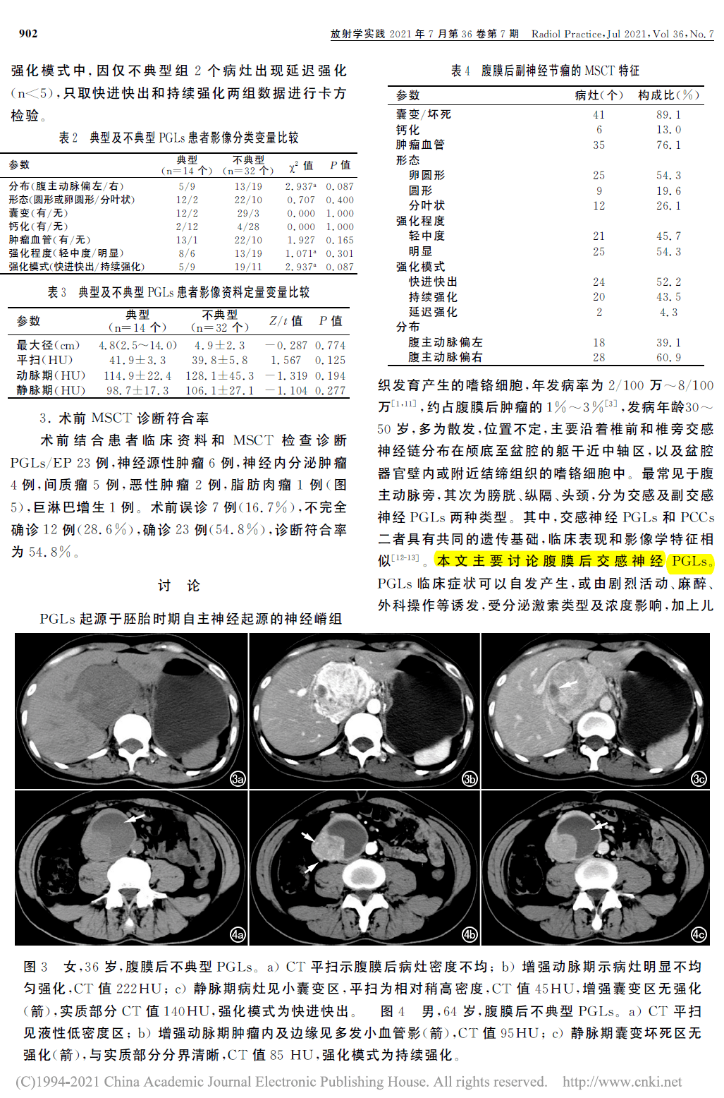 文献丨腹膜后典型及不典型副神经节瘤msct表现及鉴别诊断_病例_熊猫