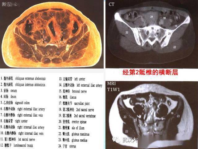 收藏史上最全的ct断层解剖图谱