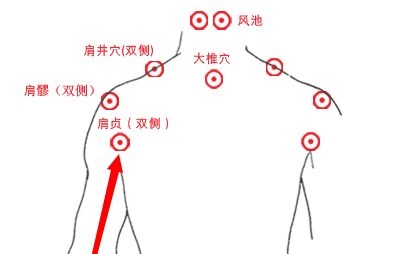 天宗穴还有一个好朋友——肩贞穴,是治疗肩部疼痛的首要穴位.