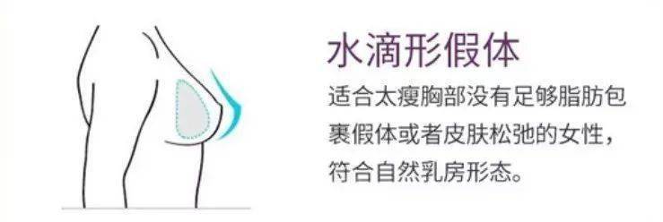 胸廓非常平坦,抑或腺体已下垂,若用水滴形假体,则会加剧乳房视觉上的