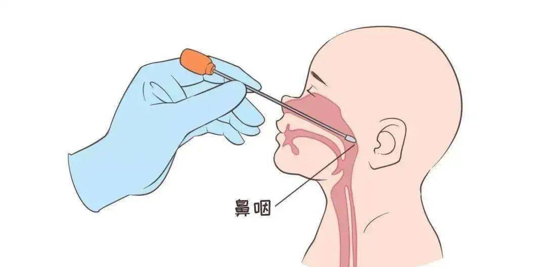 no!很抱歉不可以二,鼻咽拭子采样时,可不可以不要插得这么深?