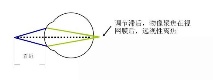 调节_眼睛_视网膜