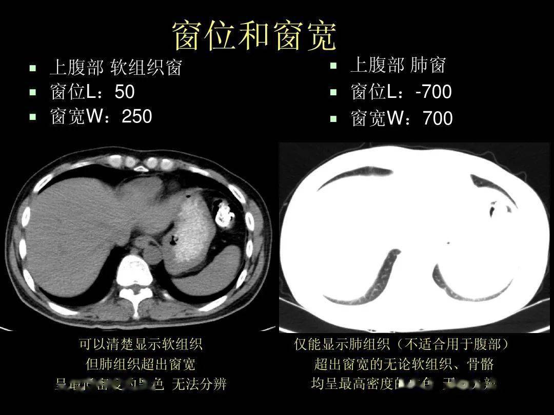 超细的腹部ct入门精美解剖图谱