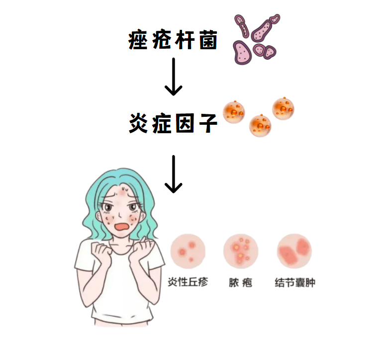 花季年华,祛痘路上,缺了这个营养素可能功亏一篑_维生素_皮肤_补充