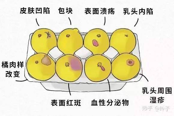 什么样的人容易得乳腺癌关于乳腺癌你要了解的都在这里