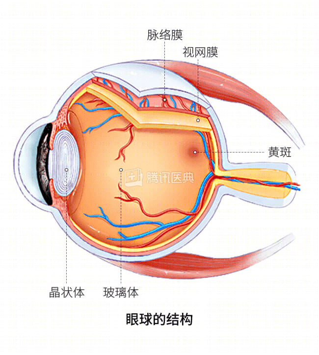 这样玩手机常见却高危一男子因此视网膜脱离