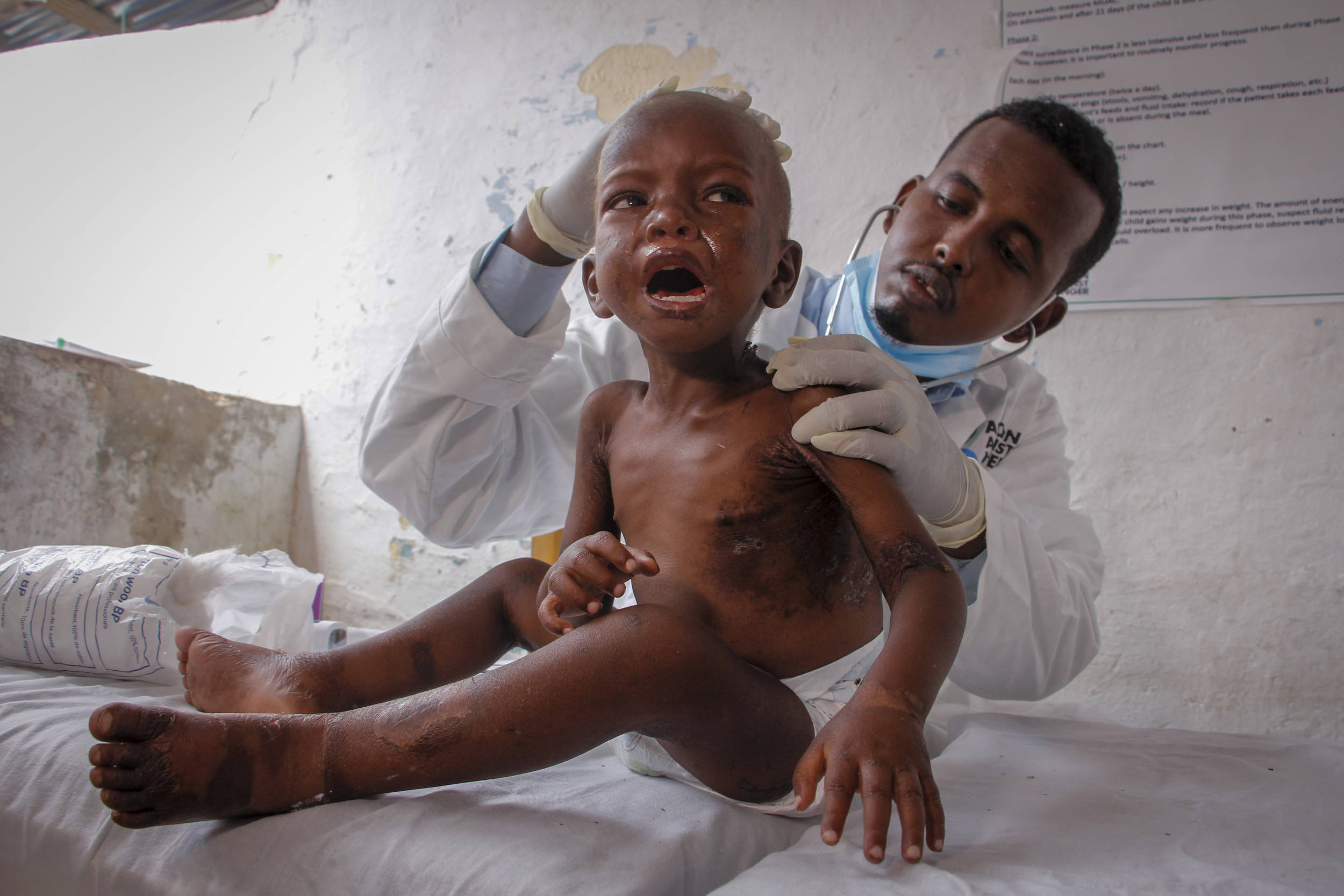 联合国：非洲之角将现大饥荒，1000多万儿童面临极端饥饿
