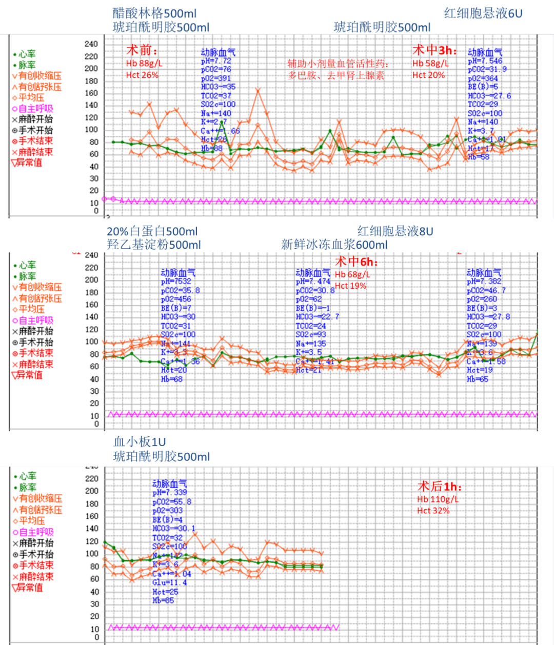 1u输液量:醋酸钠林格注射液 钾1g500ml,琥珀酰明胶(佳乐施)1500ml,羟