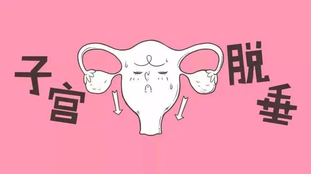 阴道掉出鸡蛋大的“肿物” 女性朋友注意啦