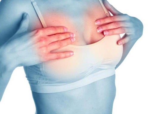 三种乳房肿块不是癌症
