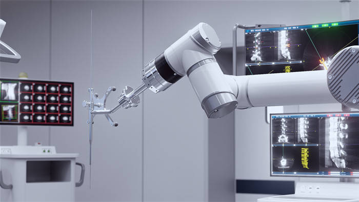 手术机器人价格多少一台-国产手术机器人发展潜力巨大