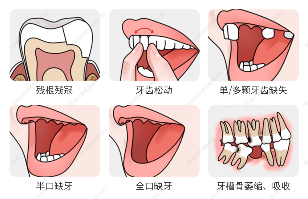 大,首次以家庭为单位,一人报名,全家使用,弥补家庭口腔健康的管理空白