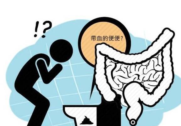 若近期有以上几个异常症状,特别是超过45岁以上,本就有癌症家族史的