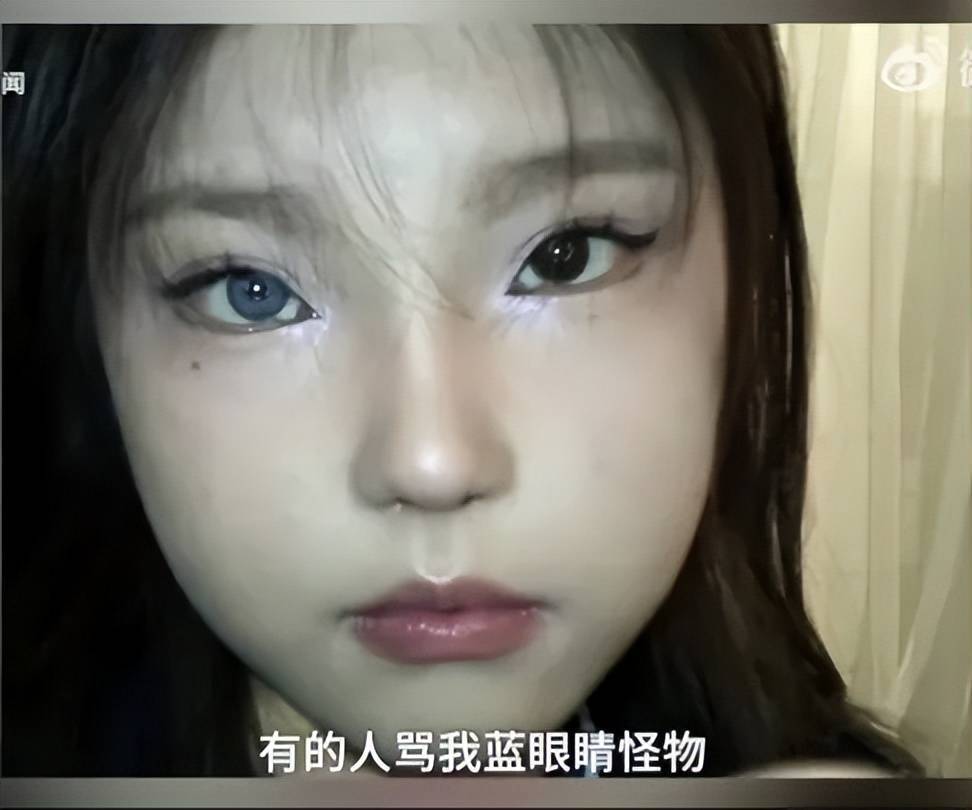 18岁女孩右眼天生蓝瞳被视为异类，网友称要活出不一样的精彩