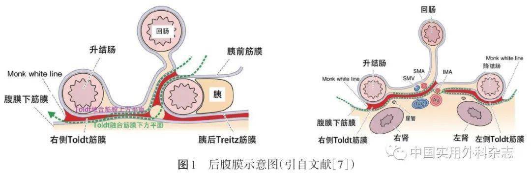 专题笔谈｜腹腔镜结直肠手术中输尿管及尿道损伤的预防及处理（本文配发视频）