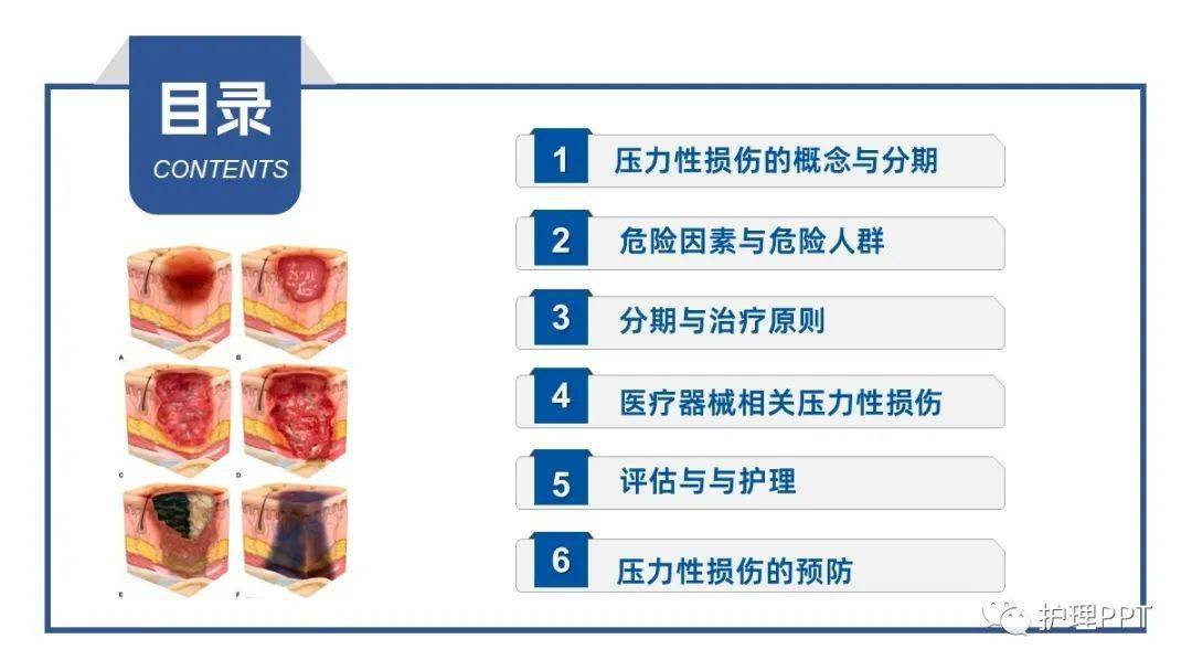 【ppt】压力性损伤（压疮）的预防与护理