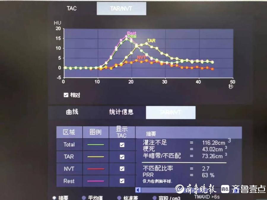 滕州中心人民医院神经内科乐成救治一例急性大血管闭塞脑梗死患者（大内科）滕州市中心人民医院神经内科专家门诊简介，