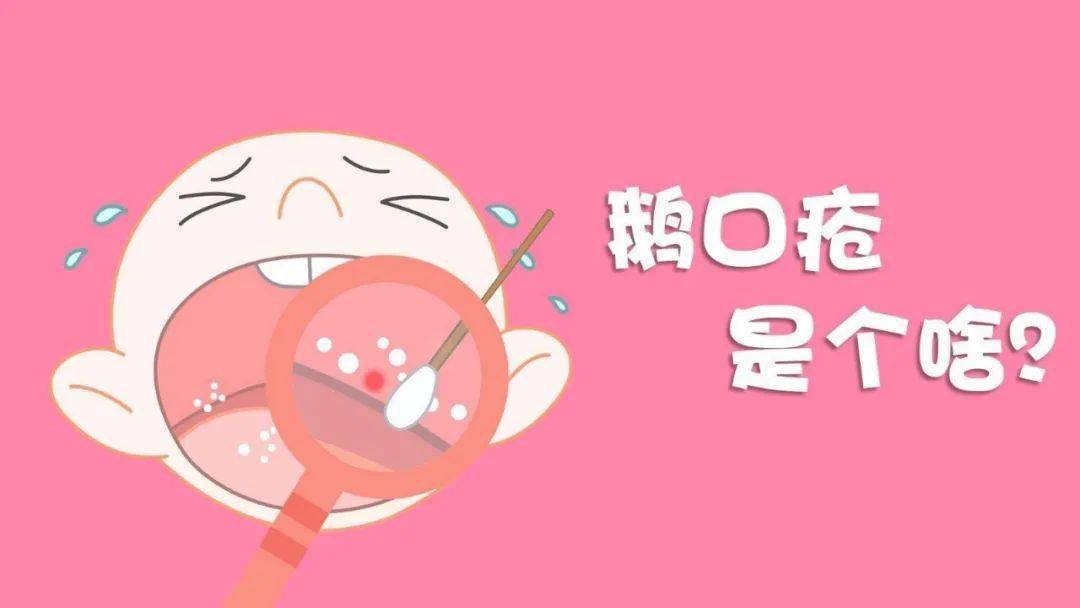 酷育儿│宝宝嘴里“奶瓣”擦不掉？上火了？口腔溃疡了？当心是鹅口疮！-搜狐大视野-搜狐新闻