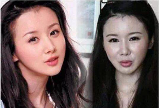 盘点整容失败的5大女星,网友:图三整后毁前程尽毁!