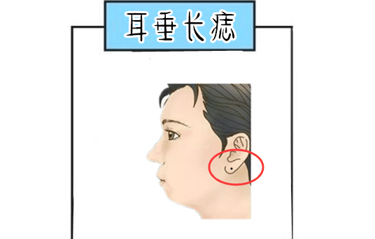 左耳垂有痣的女人面相图片