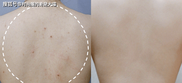 鸡皮肤用盐洗澡好吗(盐浴对鸡皮肤有作用吗)