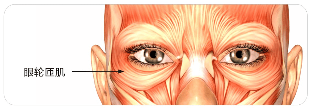 眼轮匝肌肥大图片