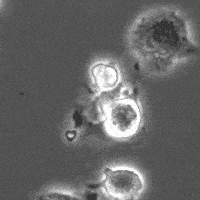 相差显微镜下神经突触创建链接(4小时内)△ 专业脑电设备测量出的