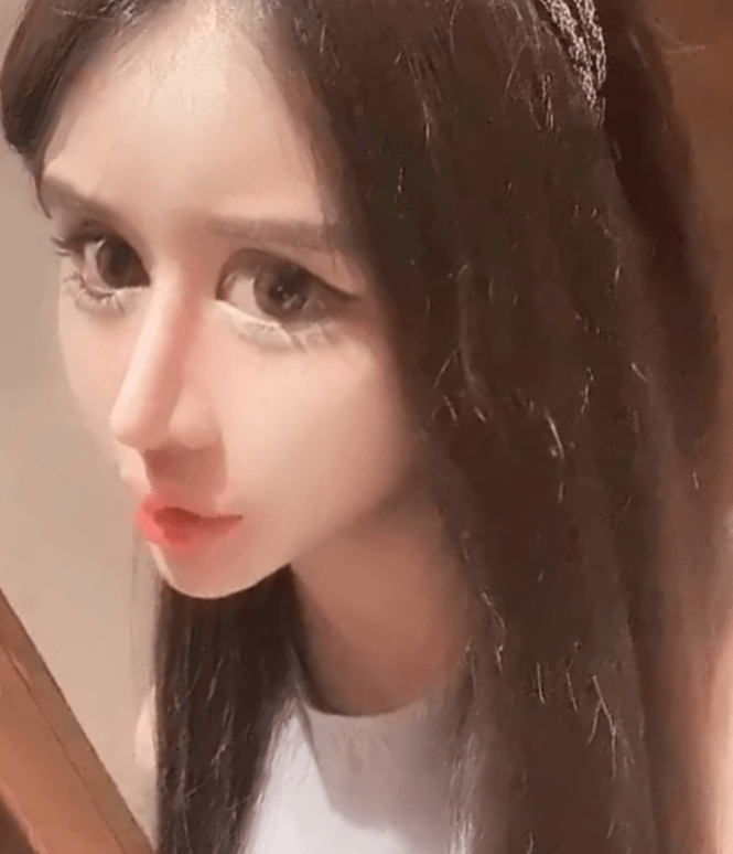 整容太多处于休学状态3年整容100次15岁女孩成网红达人