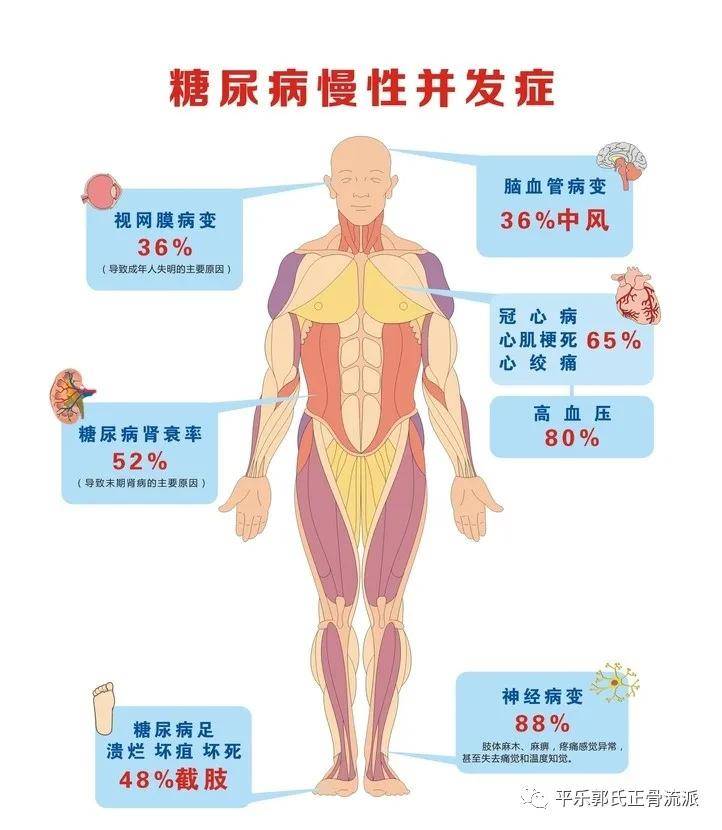 但你或许不知道,糖尿病并不可怕,可怕的是 糖尿病并发症