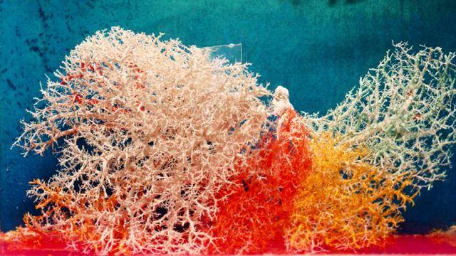 珊瑚般美丽的肝脏铸型标本(目前仍保存在东方肝胆医院展示室,吴孟超