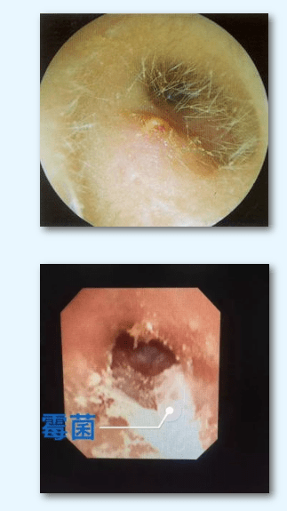 耳朵很痒可能是这6个问题别忽视了