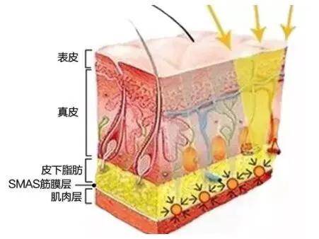 好戏开始 皮肤的衰老分为三层,表皮层,真皮层和筋膜层.