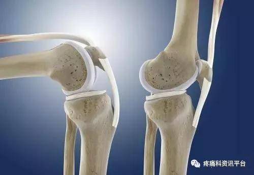 关节镜下微骨折术治疗膝关节软骨损伤