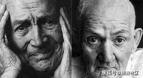 症状|老年痴呆症病因有哪些