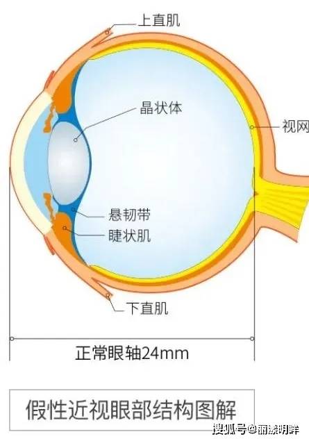 儿童年龄越小,晶状体弹性越大,眼调节能力越强