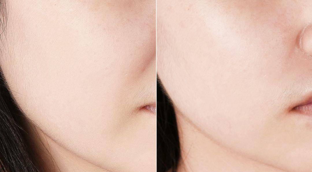 皮肤一直白不起来?很可能是你忽视了这3个细节,正确美白这样做!