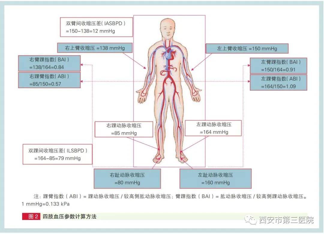 【医者医识】中国专家共识助力动脉硬化性疾病诊疗