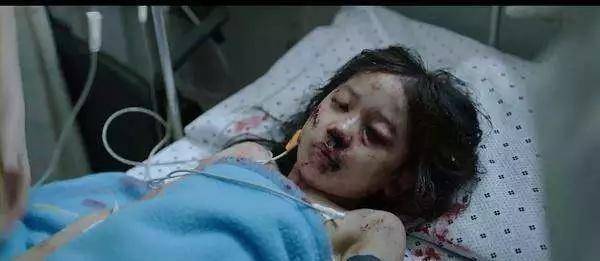 在电影素媛中小女孩的脸是怎么受伤的