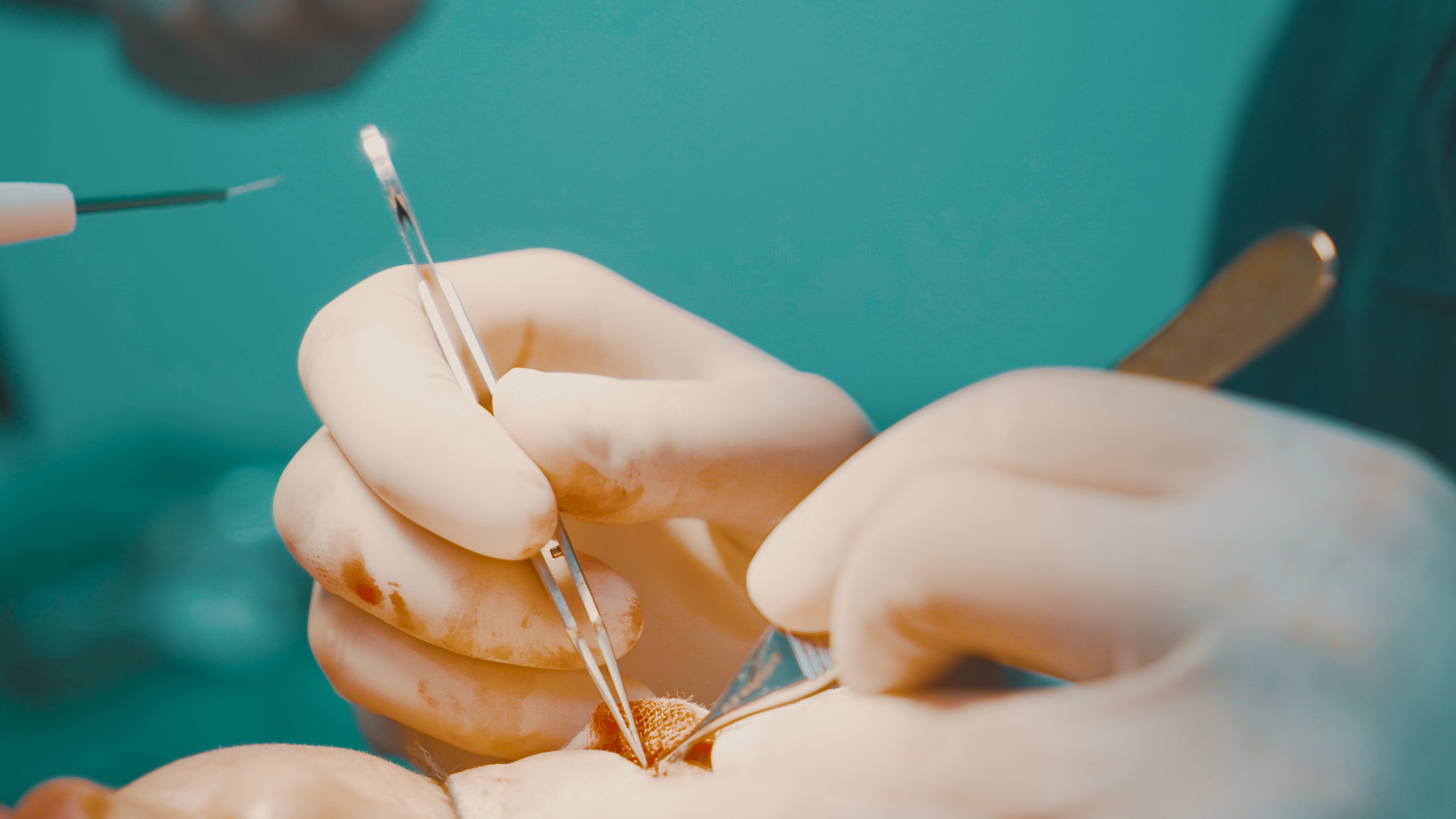 魏海军:用显微外科技术雕琢美丽人生_医生