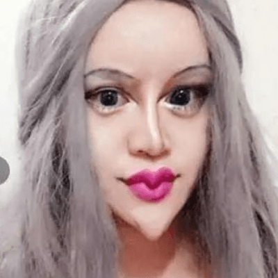 时代审美真的变了曾经整容成蛇精脸的刘梓晨如今把脸蛋填充成包子