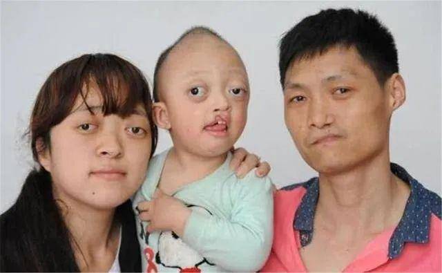 男孩遗传3代人缺点父母都有先天缺陷生下孩子是爱还是残忍