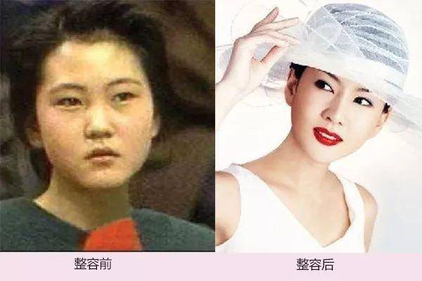 金南珠韩国小姐出身转型演员 坦荡承认整容 李美妍是其丈夫前妻