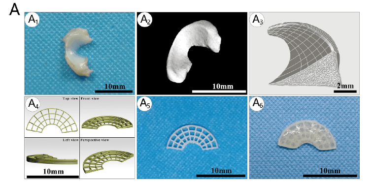 半月板再生:3d打印pcl-mecm的水凝胶混合支架