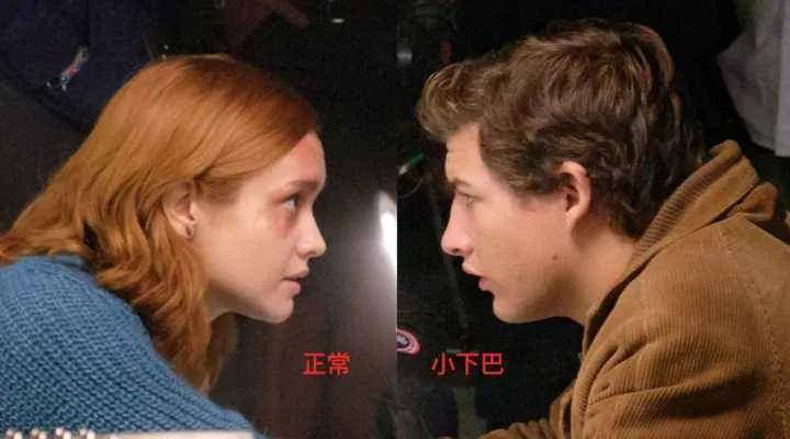 双眼皮|顾客要整成明星？参考这个照着做就行了